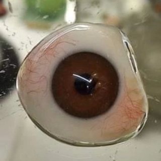 Prótesis ocular en proceso de fabricación sumergida en líquido