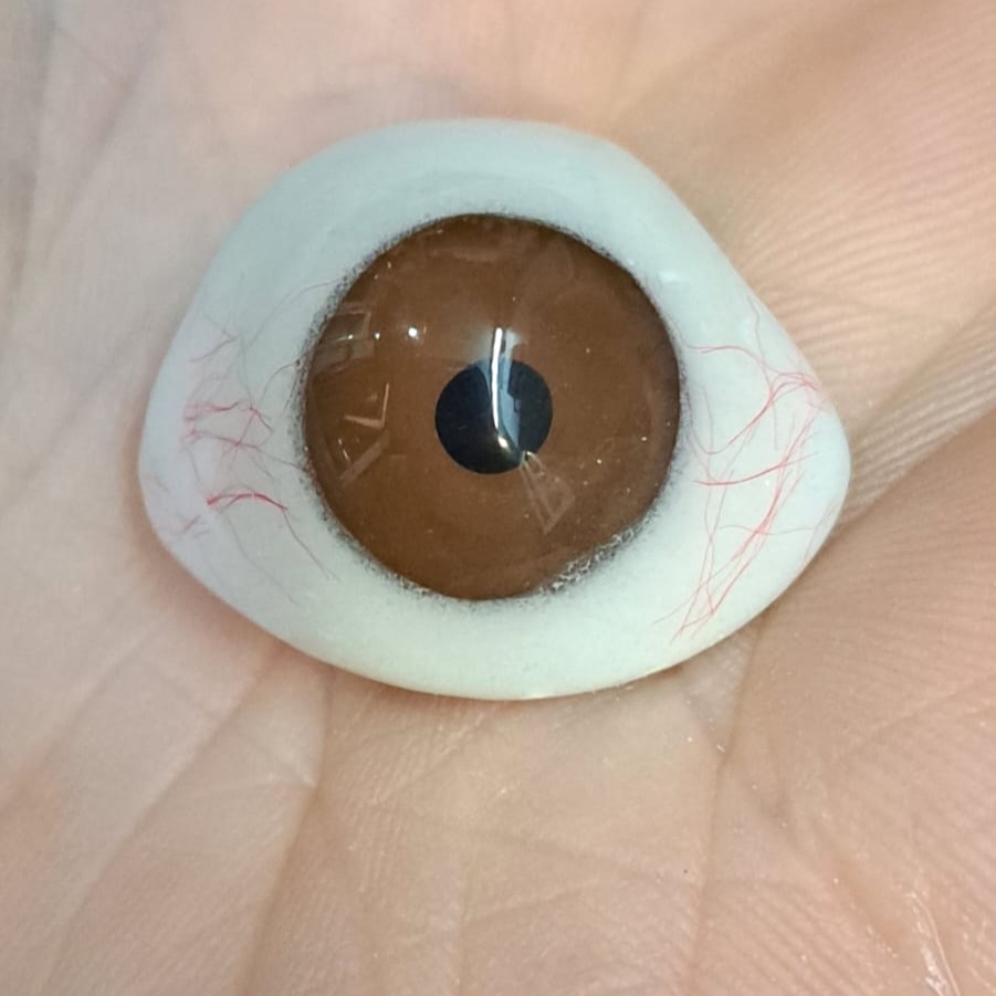 Prótesis ocular personalizada con iris marrón sostenida en la palma de la mano