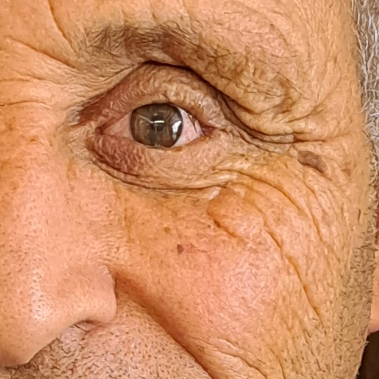 Dos prótesis oculares de distinto tamaño sobre superficie gris
